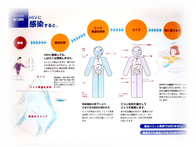 図：HIVに感染すると